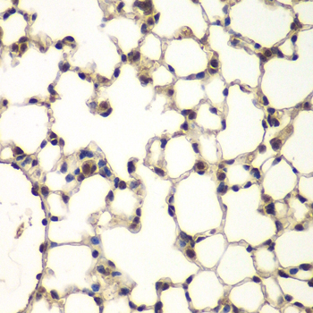 Immunohistochemistry - PHF11 Polyclonal Antibody 
