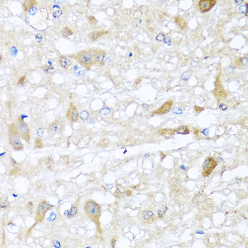 Immunohistochemistry - CBR4 Polyclonal Antibody 