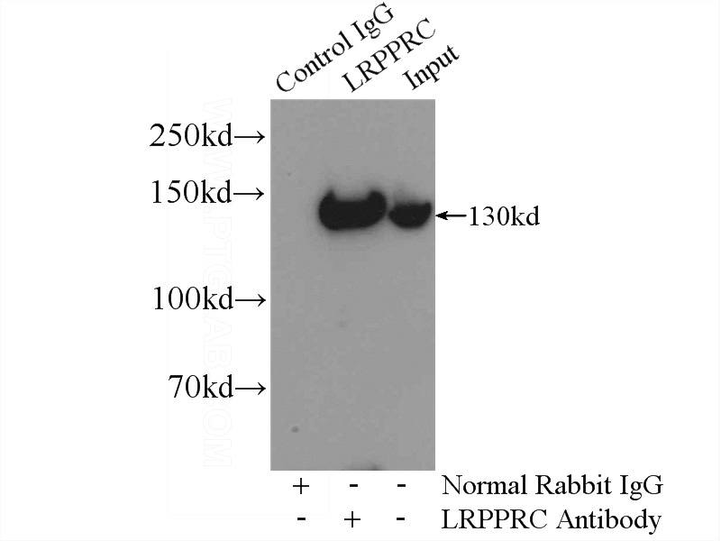 IP Result of anti-LRPPRC (IP:Catalog No:112325, 5ug; Detection:Catalog No:112325 1:1000) with HeLa cells lysate 1200ug.