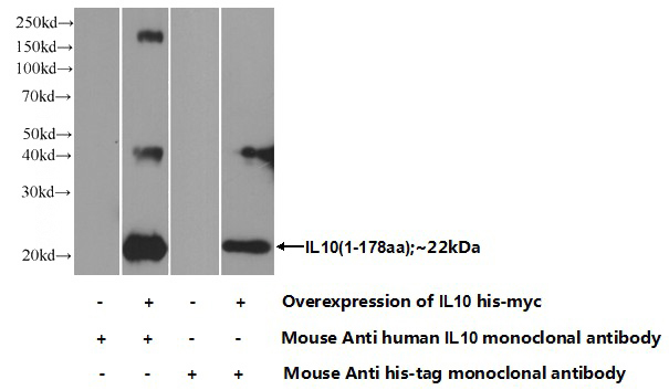Transfected HEK-293 cells were subjected to SDS PAGE followed by western blot with Catalog No:107378(IL10 Antibody) at dilution of 1:1000