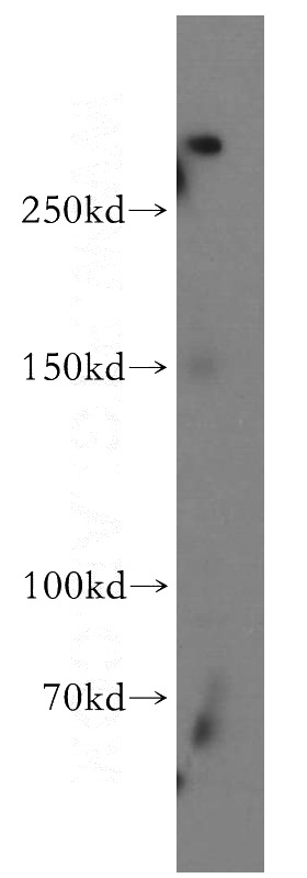 human brain tissue were subjected to SDS PAGE followed by western blot with Catalog No:115263(SHANK1 antibody) at dilution of 1:300