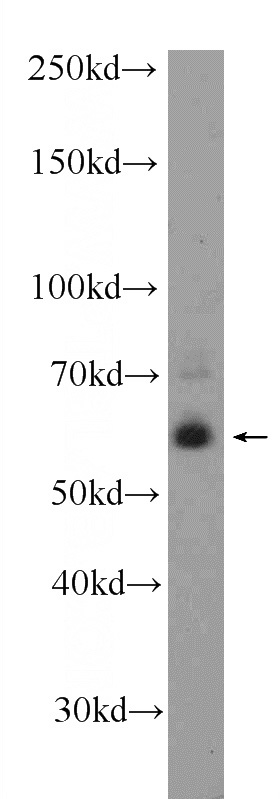 SH-SY5Y cells were subjected to SDS PAGE followed by western blot with Catalog No:111980(KCNV1 Antibody) at dilution of 1:300