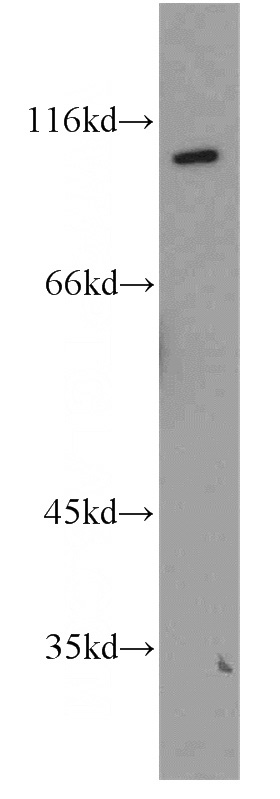 HEK-293 cells were subjected to SDS PAGE followed by western blot with Catalog No:113268(NR3C2 antibody) at dilution of 1:1000