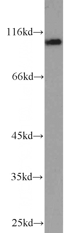 mouse brain tissue were subjected to SDS PAGE followed by western blot with Catalog No:112752(MPHOSPH8 antibody) at dilution of 1:1500