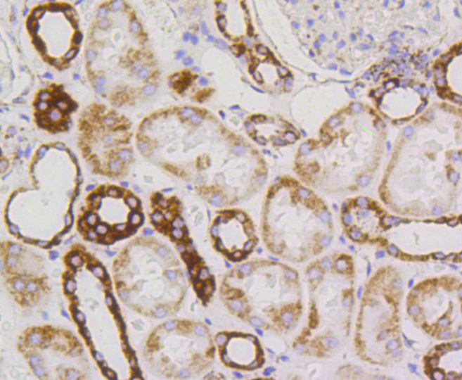Immunohistochemistry - TSPO Monoclonal Antibody 