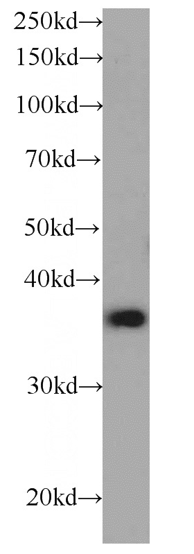 Jurkat cells were subjected to SDS PAGE followed by western blot with Catalog No:107032(CAPZA1 antibody) at dilution of 1:500