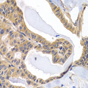 Immunohistochemistry - PTGIR Polyclonal Antibody 