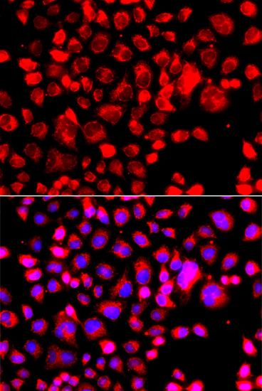 Immunofluorescence - CCL11 Polyclonal Antibody 