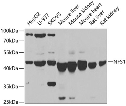 Western blot - NFS1 Polyclonal Antibody 