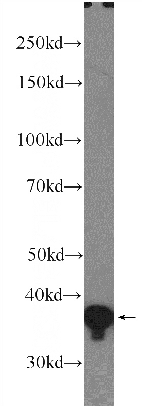 HeLa cells were subjected to SDS PAGE followed by western blot with Catalog No:108257(LDLRAP1 Antibody) at dilution of 1:1000