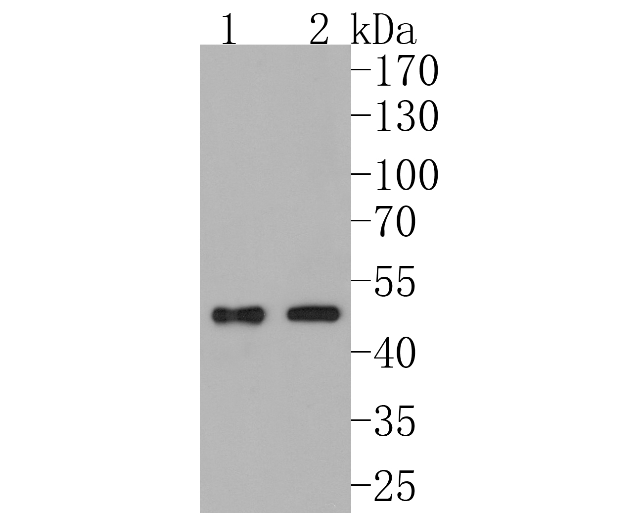 Anti-PDK1 antibody
