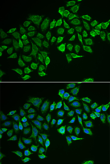 Immunofluorescence - RHOD Polyclonal Antibody 