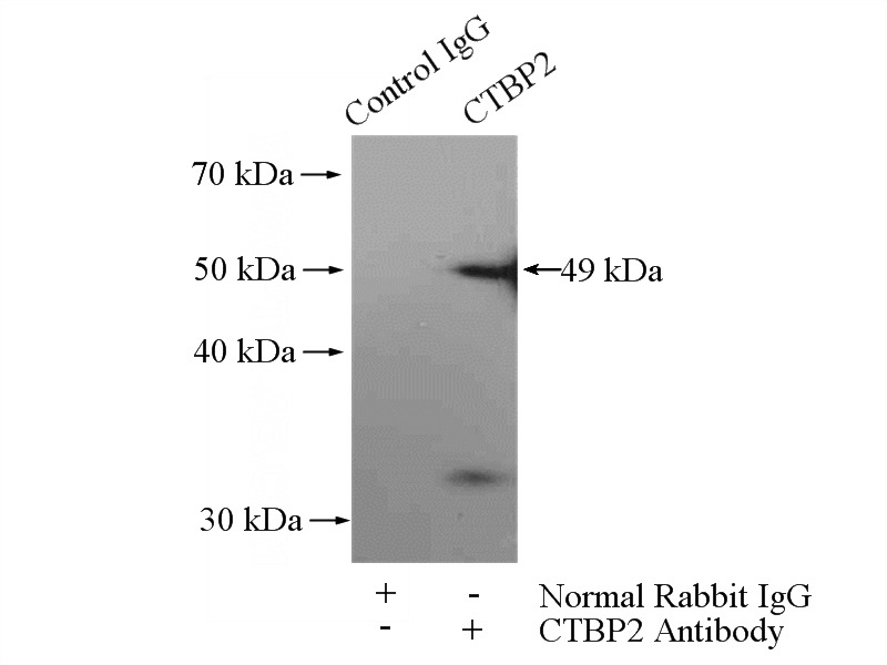 IP Result of anti-CTBP2 (IP:Catalog No:109625, 4ug; Detection:Catalog No:109625 1:500) with mouse heart tissue lysate 3200ug.