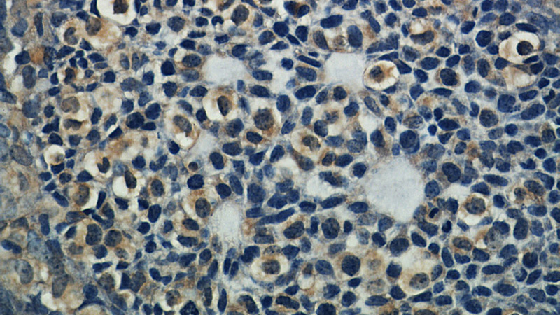 Immunohistochemical of paraffin-embedded human ovary using Catalog No:112299(LPAR4 antibody) at dilution of 1:50 (under 40x lens)