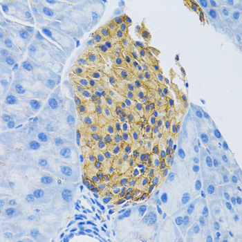 Immunohistochemistry - SLC1A2 Polyclonal Antibody 