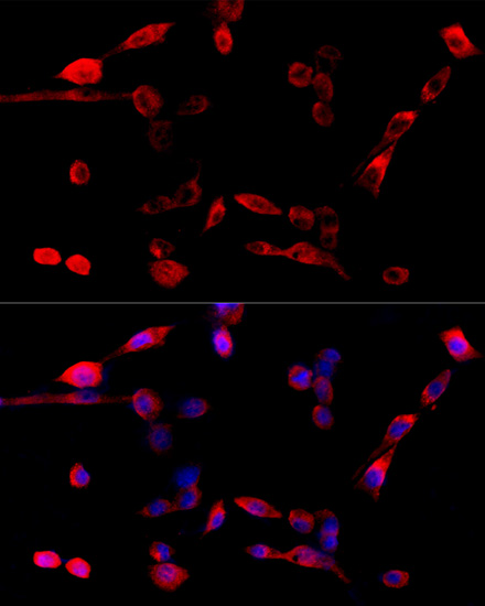 Immunofluorescence - ASPSCR1 Polyclonal Antibody 