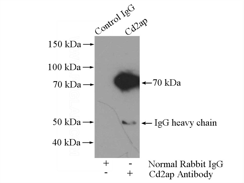 IP Result of anti-Cd2ap (IP:Catalog No:109018, 4ug; Detection:Catalog No:109018 1:2000) with mouse brain tissue lysate 2560ug.