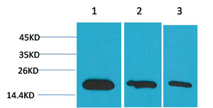 Western blot analysis of 1) Hela, 2) 293, 3) PC12 using Survivin Monoclonal Antibody.