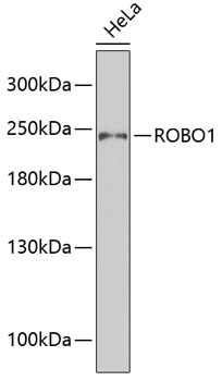 Western blot - ROBO1 Polyclonal Antibody 