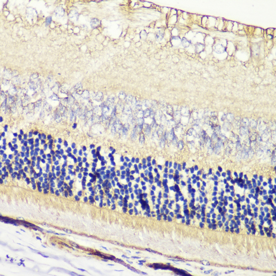 Immunohistochemistry - GRK1 Polyclonal Antibody 