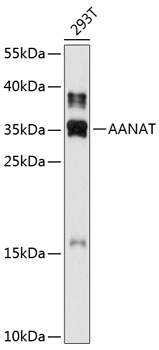 Western blot - AANAT Polyclonal Antibody 
