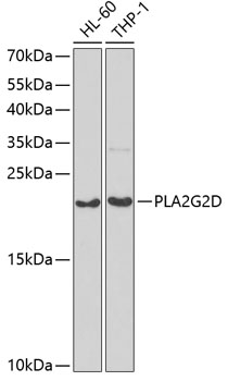 Western blot - PLA2G2D Polyclonal Antibody 
