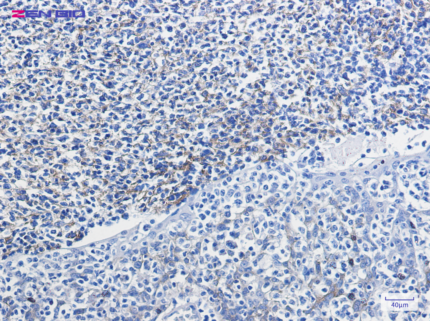 Immunohistochemistry of VCAM1 in paraffin-embedded Human tonsil using VCAM1 Rabbit pAb at dilution 1/100