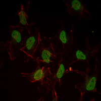 Immunofluorescence analysis of Hela cells using ESR1 mouse mAb (green). Red