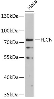 Western blot - FLCN Polyclonal Antibody 