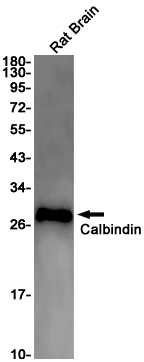 Western blot detection of Calbindin in Rat Brain lysates using Calbindin Rabbit pAb(1:1000 diluted).Predicted band size:30kDa.Observed band size:30kDa.