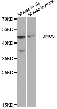 Western blot - PSMC3 Polyclonal Antibody 