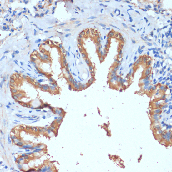 Immunohistochemistry - HHLA2 Polyclonal Antibody 