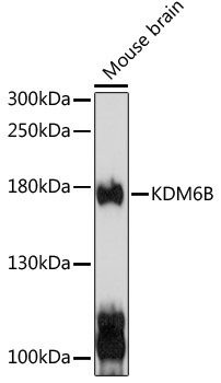 Western blot - Kdm6b Polyclonal Antibody 