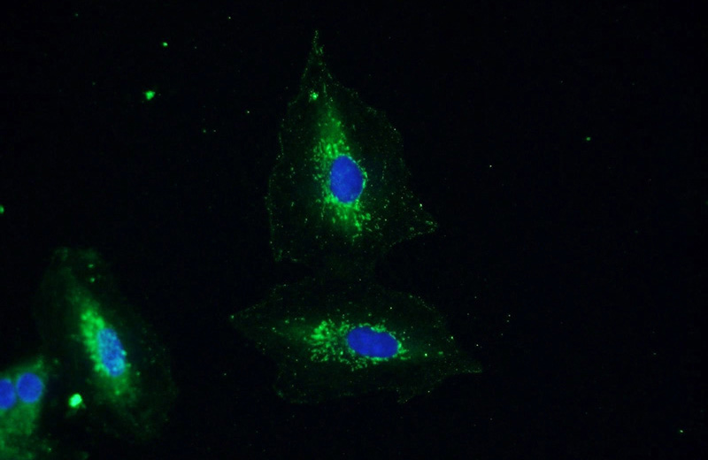 Immunofluorescent analysis of A549 cells using Catalog No:112627(MIP­3β Antibody) at dilution of 1:50 and Alexa Fluor 488-congugated AffiniPure Goat Anti-Rabbit IgG(H+L)