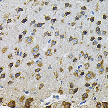 Immunohistochemistry - NCF4 Polyclonal Antibody 