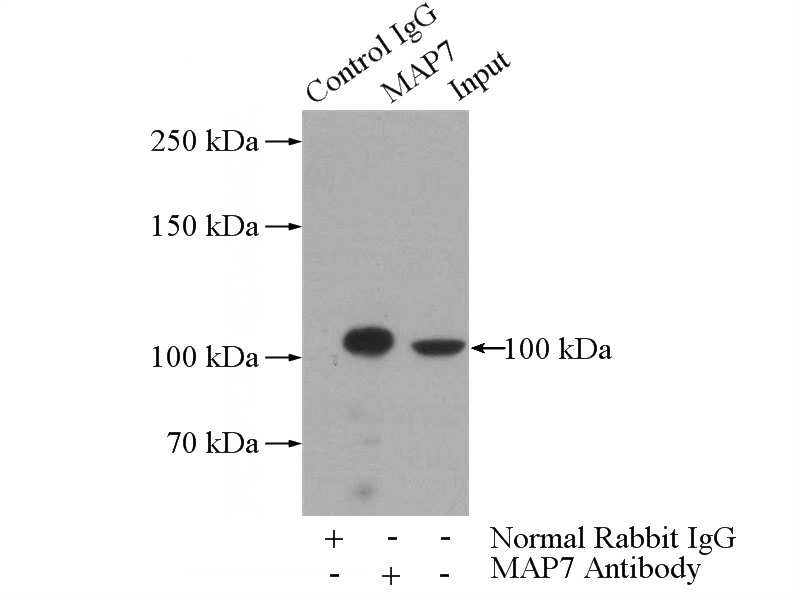 IP Result of anti-MAP7 (IP:Catalog No:112428, 4ug; Detection:Catalog No:112428 1:500) with HeLa cells lysate 2000ug.