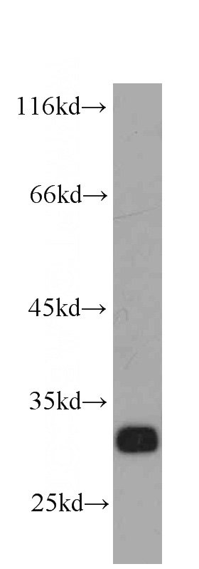 Jurkat cells were subjected to SDS PAGE followed by western blot with Catalog No:107615(STX6 antibody) at dilution of 1:1000