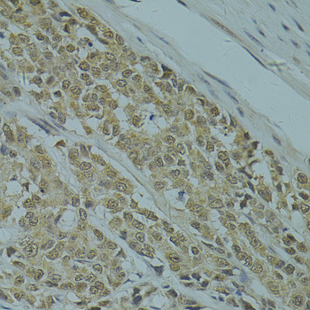 Immunohistochemistry - RSRC1 Polyclonal Antibody 