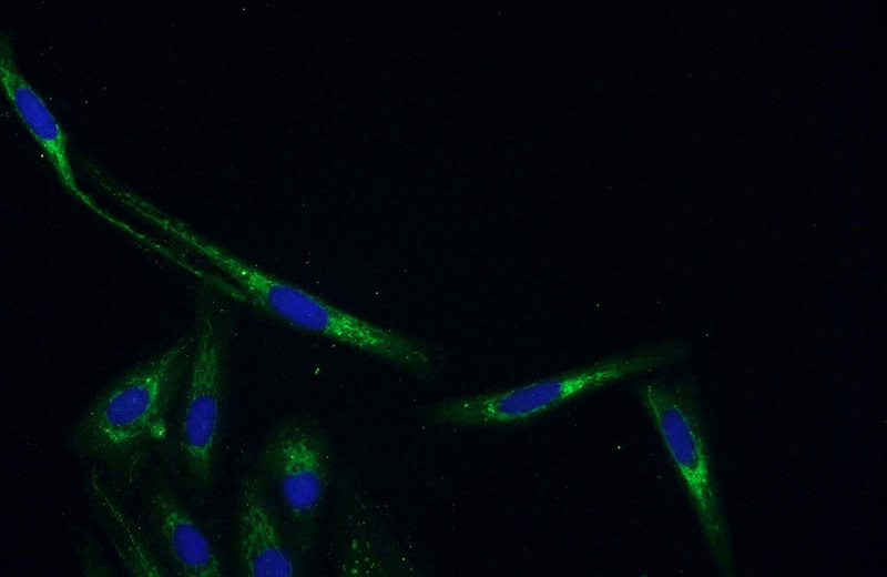 Immunofluorescent analysis of SKOV-3 cells using Catalog No:116965(ZNF251 Antibody) at dilution of 1:50 and Alexa Fluor 488-congugated AffiniPure Goat Anti-Rabbit IgG(H+L)
