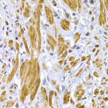 Immunohistochemistry - DSP Polyclonal Antibody 
