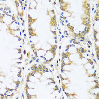 Immunohistochemistry - BLOC1S3 Polyclonal Antibody 