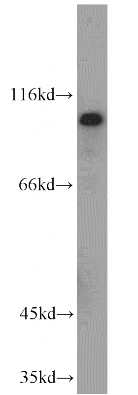 A375 cells were subjected to SDS PAGE followed by western blot with Catalog No:111453(HPS4 antibody) at dilution of 1:200