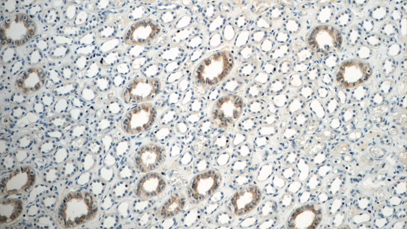Immunohistochemistry of paraffin-embedded human kidney tissue slide using Catalog No:111125(GPR3 Antibody) at dilution of 1:50 (under 10x lens)
