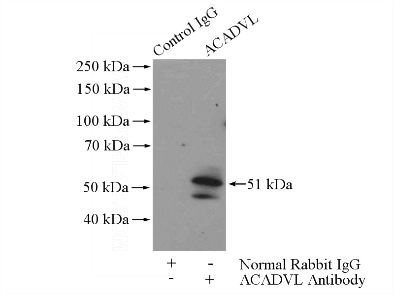 IP Result of anti-ACADVL (IP:Catalog No:107723, 4ug; Detection:Catalog No:107723 1:500) with HeLa cells lysate 2800ug.