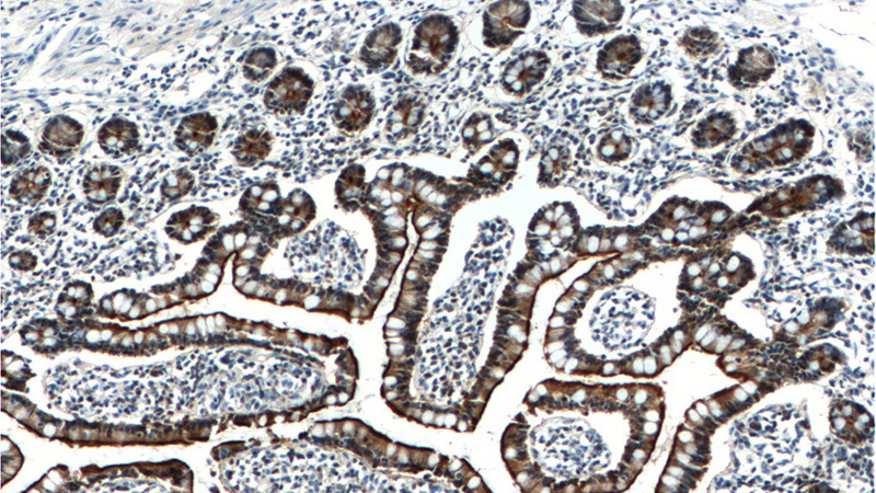 Immunohistochemistry of paraffin-embedded human small intestine tissue slide using Catalog No:116752(VIL1 Antibody) at dilution of 1:2000 (under 10x lens).