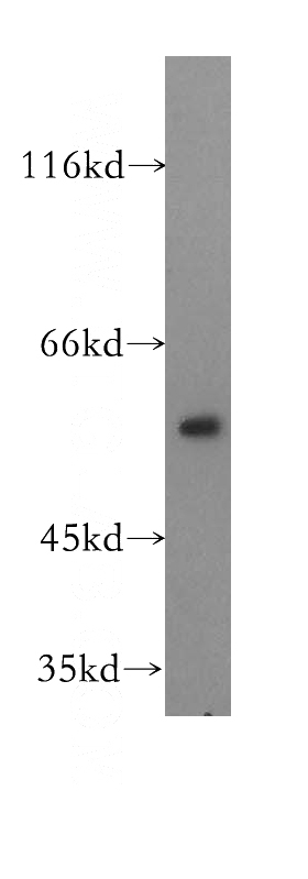 human liver tissue were subjected to SDS PAGE followed by western blot with Catalog No:109987(DLD antibody) at dilution of 1:500