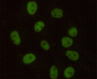 Immunocytochemistry stain of Hela using DNA-PKcs mouse mAb (1:100).