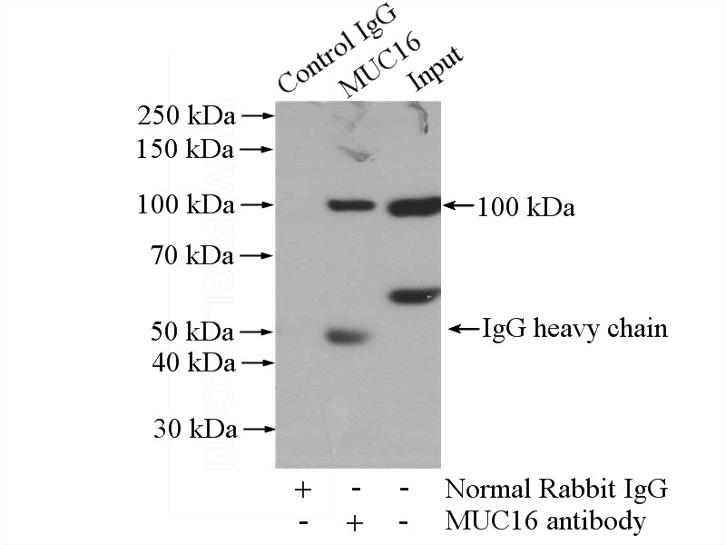 IP Result of anti-MUC16,CA125 (IP:Catalog No:112889, 4ug; Detection:Catalog No:112889 1:600) with HeLa cells lysate 1200ug.
