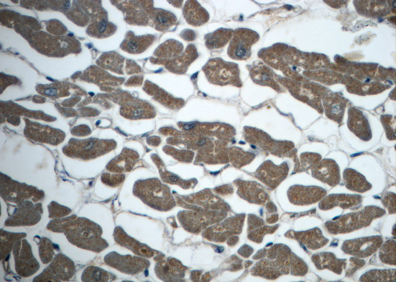 Immunohistochemistry of paraffin-embedded human heart slide using Catalog No:112633(MEF2C Antibody) at dilution of 1:50