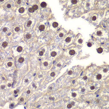 Immunohistochemistry - ST14 Polyclonal Antibody 